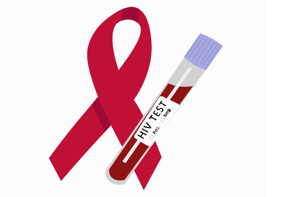 test HIV