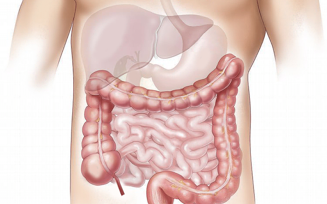 Les Maladies Inflammatoires Chroniques de l&rsquo;Intestin (MICI)